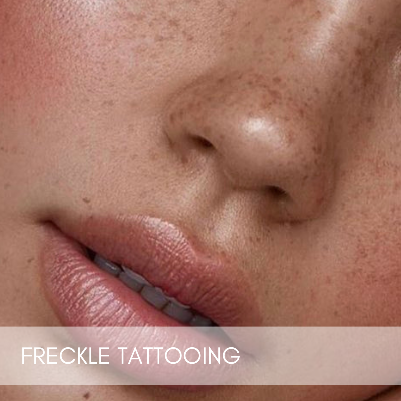 Freckle Tattooing